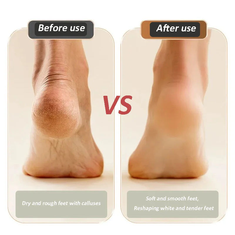 🔥VENTE LIMITÉE 50 % DE RÉDUCTION🔥 2025 nouvelle pédicure et meuleuse de pieds rechargeables par USB