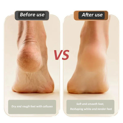 🔥VENTE LIMITÉE 50 % DE RÉDUCTION🔥 2025 nouvelle pédicure et meuleuse de pieds rechargeables par USB