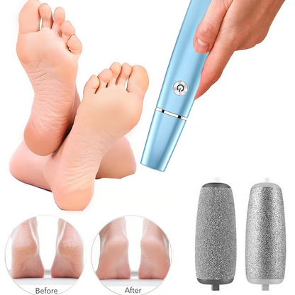 🔥VENTE LIMITÉE 50 % DE RÉDUCTION🔥Extracteur de callosités électrique pour les pieds