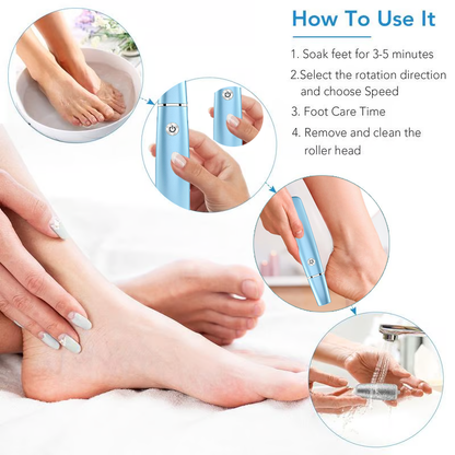 🔥VENTE LIMITÉE 50 % DE RÉDUCTION🔥Extracteur de callosités électrique pour les pieds