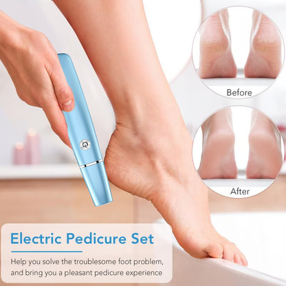 🔥VENTE LIMITÉE 50 % DE RÉDUCTION🔥Extracteur de callosités électrique pour les pieds
