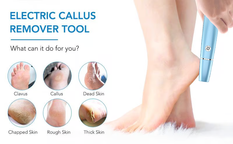 🔥VENTE LIMITÉE 50 % DE RÉDUCTION🔥Extracteur de callosités électrique pour les pieds