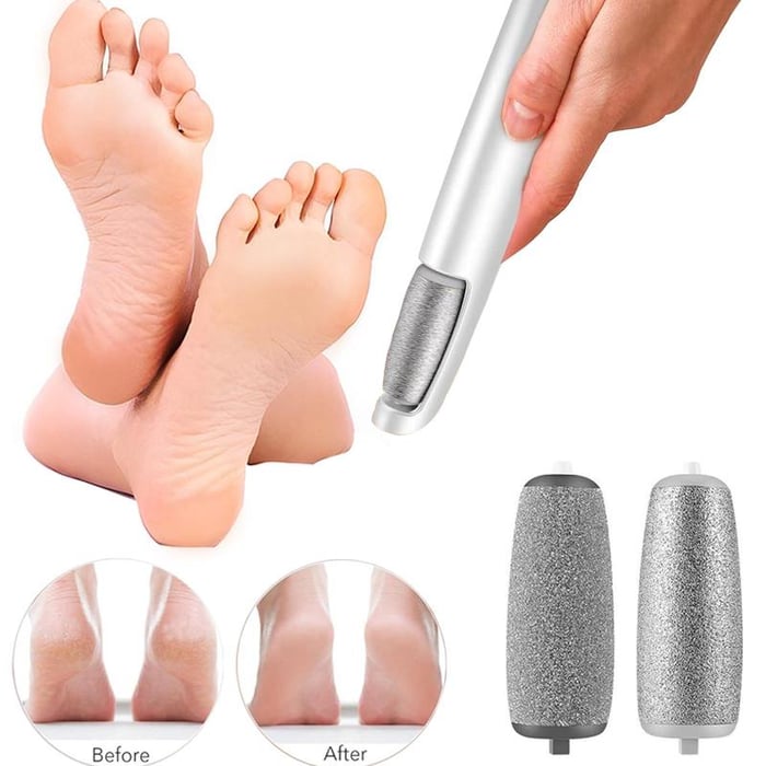 🔥VENTE LIMITÉE 50 % DE RÉDUCTION🔥Extracteur de callosités électrique pour les pieds